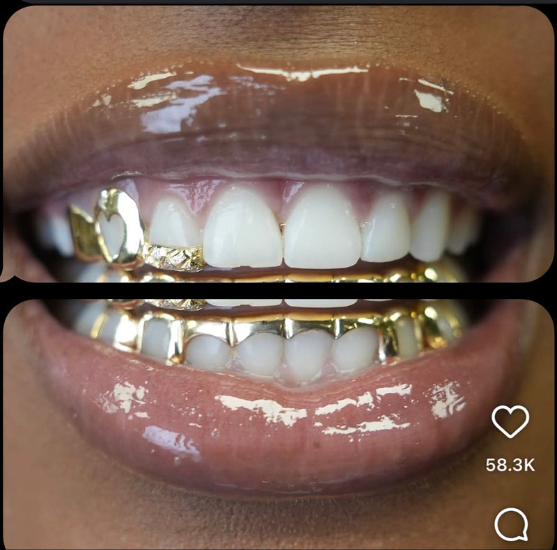 Custom 10K Gold Grill with VS Diamonds