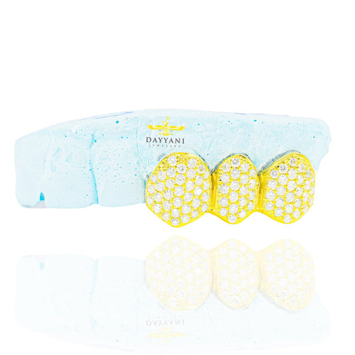 3-Piece Diamond Grill