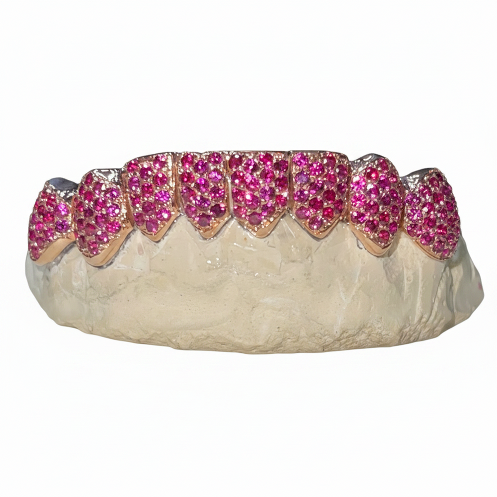 Custom Gemstone Set Grillz