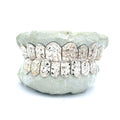 Mirror Cut Grillz and Diamond Dust