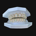 Opal With Natural Diamond Set Grillz