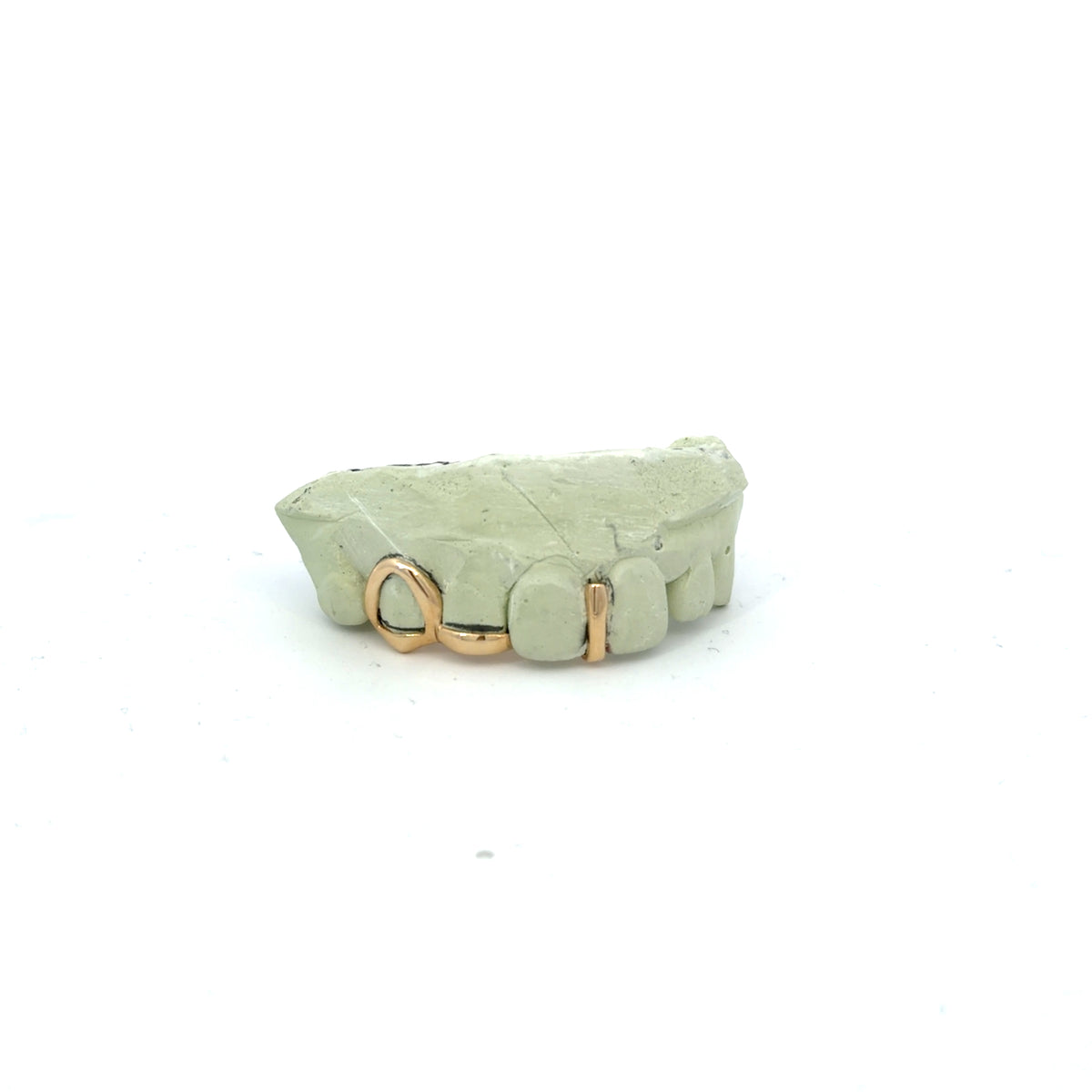 Open-Face + Tip and Spacer