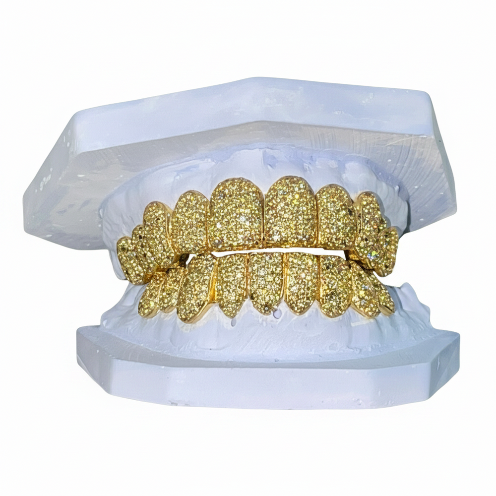 Yellow Canary Natural Diamond Zig Zag Set Grillz